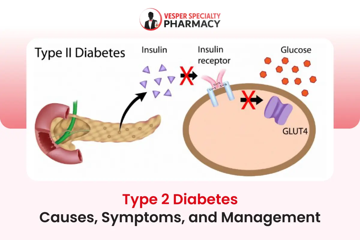 Type 2 Diabetes: Causes, Symptoms, and Management